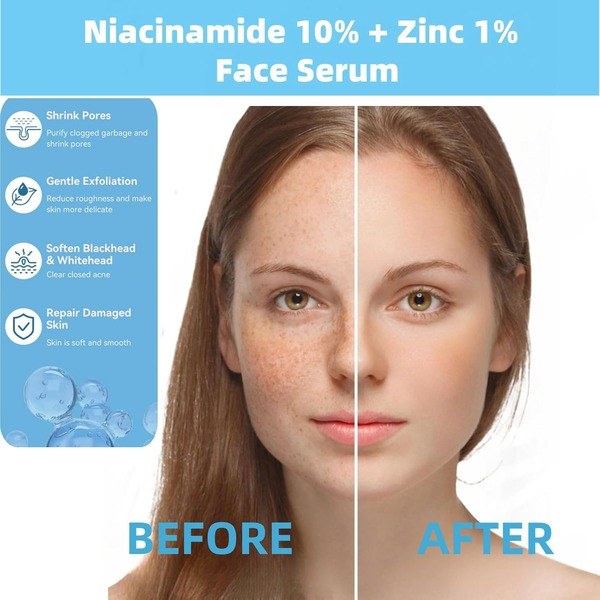 AFCRYIYE Niacinamide 10% + Zinc 1% Serum - Ingredients View - for Sale in Kenya