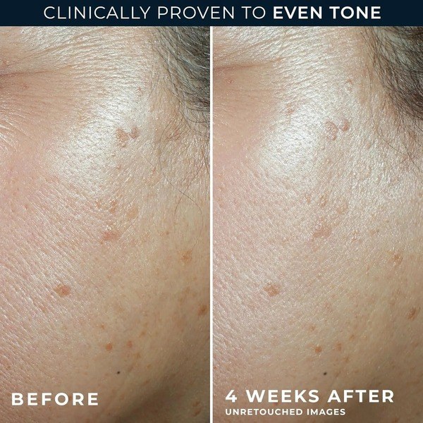 RoC RoC Multi Correxion Even Tone + Lift Moisturizer SPF 30 - Angle View - for Sale in Kenya