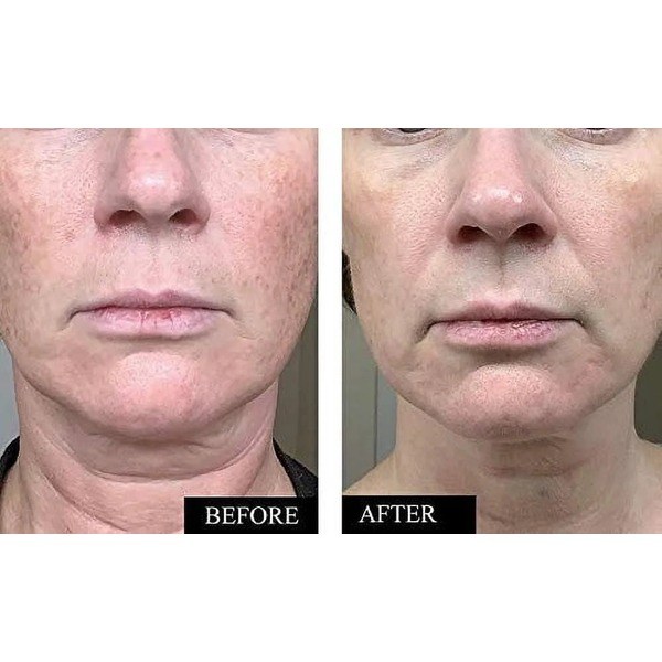 Kleem Organics KLEEM ORGANICS Vitamin C Serum for Face - Back View - for Sale in Kenya