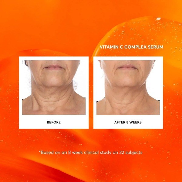Naturium Naturium Vitamin C Complex Face Serum - Angle View - for Sale in Kenya
