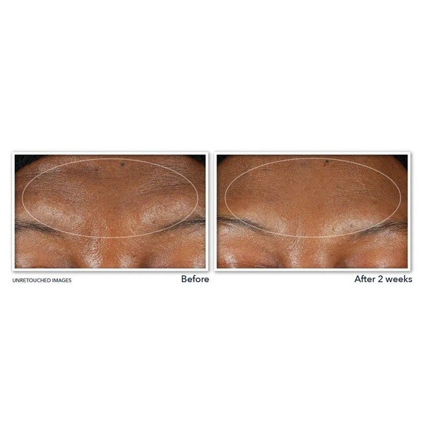 RoC RETINOL CORREXION® Deep Wrinkle Serum Cleanser - Angle View - for Sale in Kenya