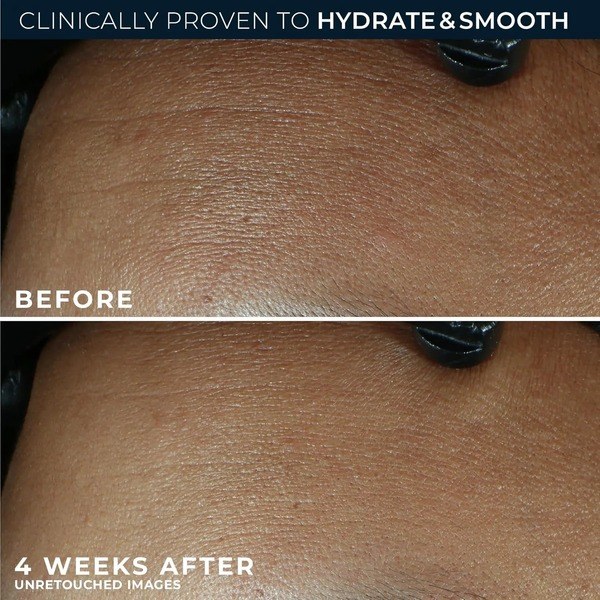 RoC RoC Retinol Correxion Max Daily Hydration Cream - Angle View - for Sale in Kenya