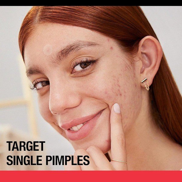 Neutrogena Neutrogena Stubborn Acne Pimple Patches - Angle View - for Sale in Kenya