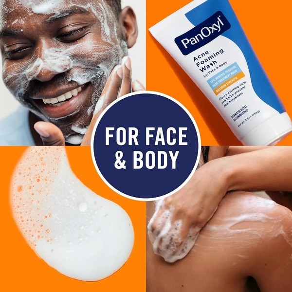 PanOxyl PanOxyl Acne Foaming Wash 156 g - Angle View - for Sale in Kenya