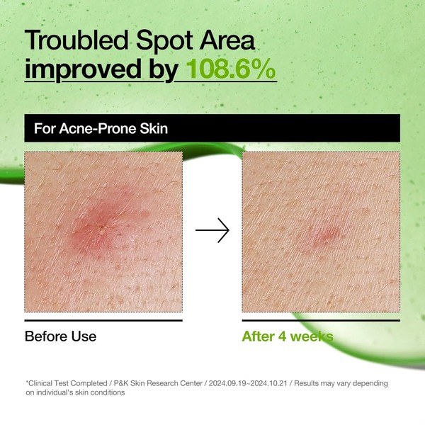 ANUA Anua Azelaic Acid 10 Hyaluron Facial Serum - Ingredients View - for Sale in Kenya