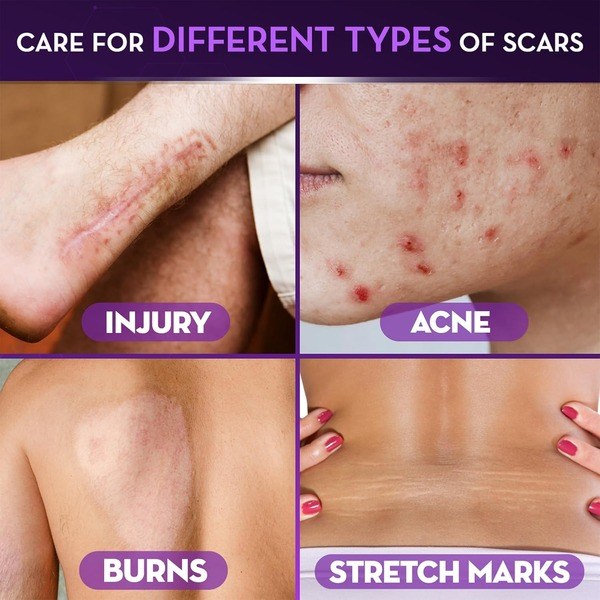cicatricure Cicatricure Advanced Scar Gel - Ingredients View - for Sale in Kenya