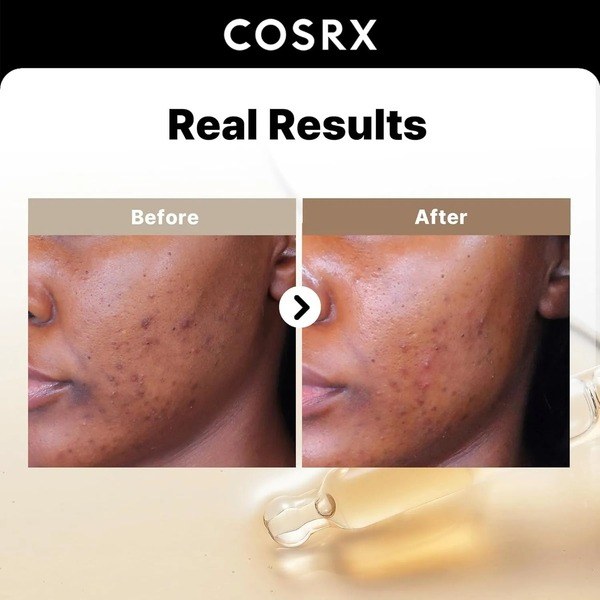 COSRX COSRX 2% Alpha Arbutin - Back View - for Sale in Kenya